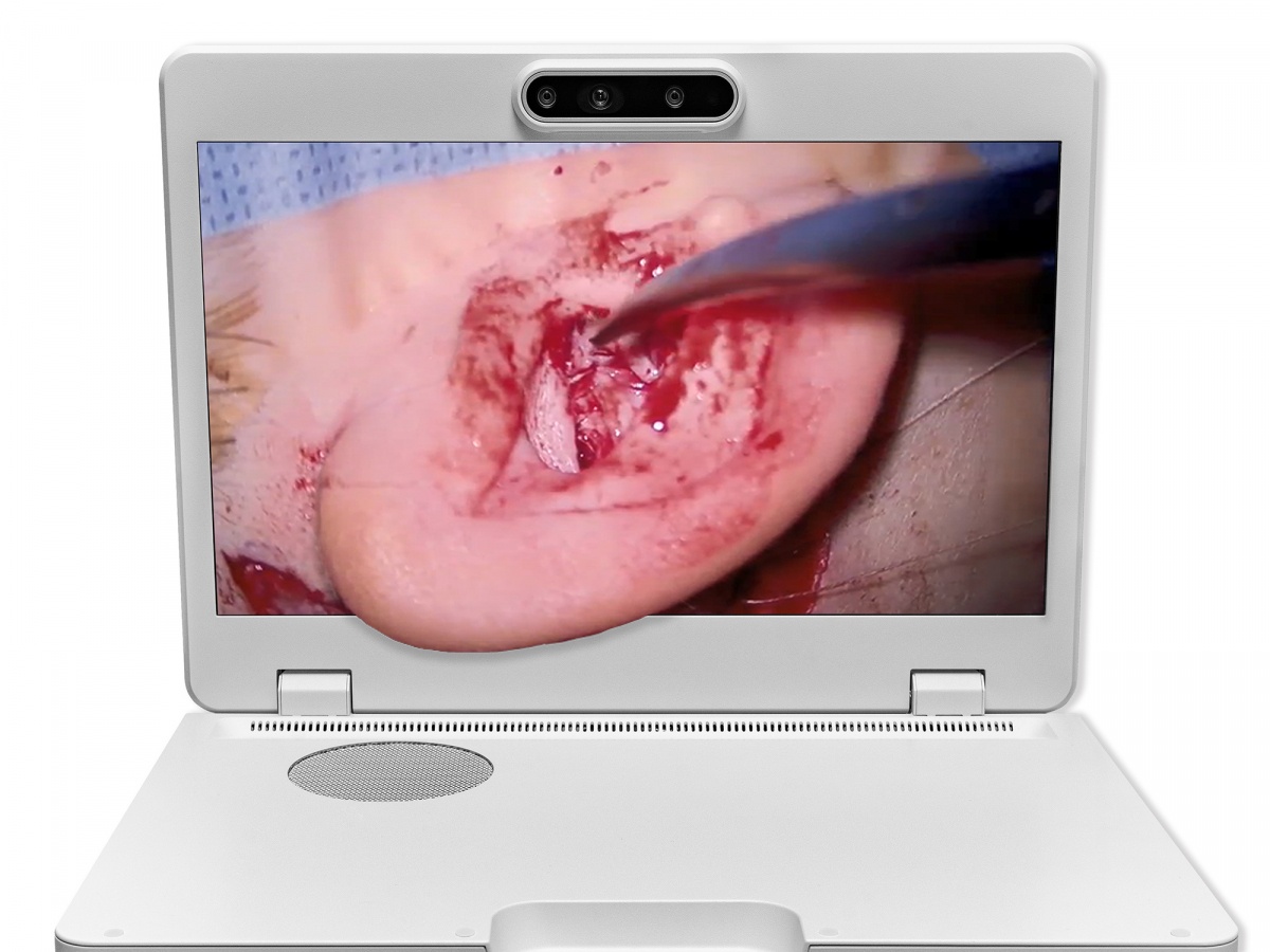 达擎之＂Heads-up 3D显微手术显示系统＂，整合4K裸眼3D显示及眼球追踪系统，具备快速追踪人眼移动位置功能，减轻医师长时间维持固定姿势的负担，让医师能有更宽广清晰的3D立体视野及更舒适的姿势来执行手术。